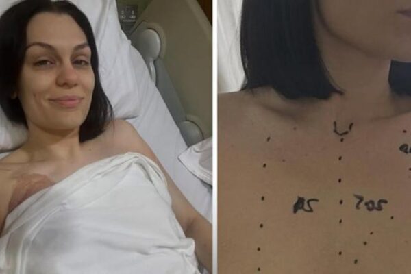 Jessie J’s Battle with Cancer: A Story of Strength