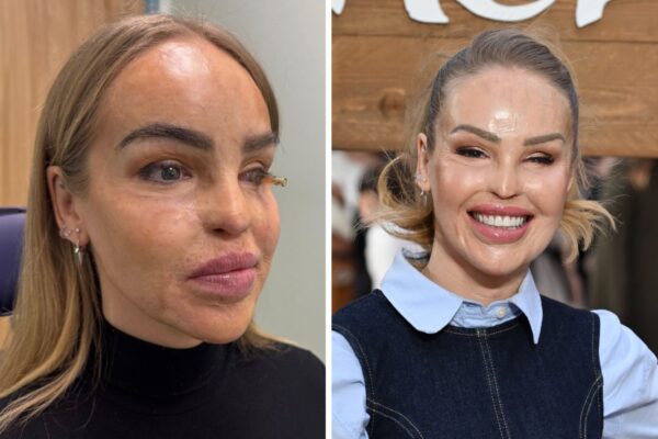 The Inspiring Journey of Katie Piper