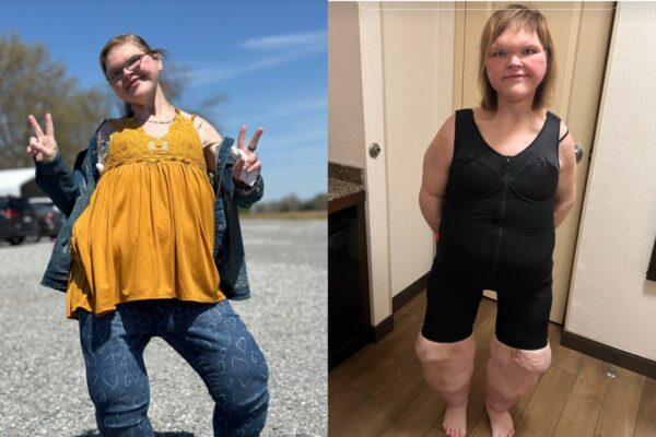 Tammy Slaton’s Remarkable Transformation Journey