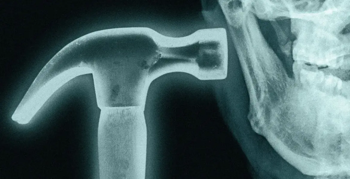 looksmaxxing — GB news