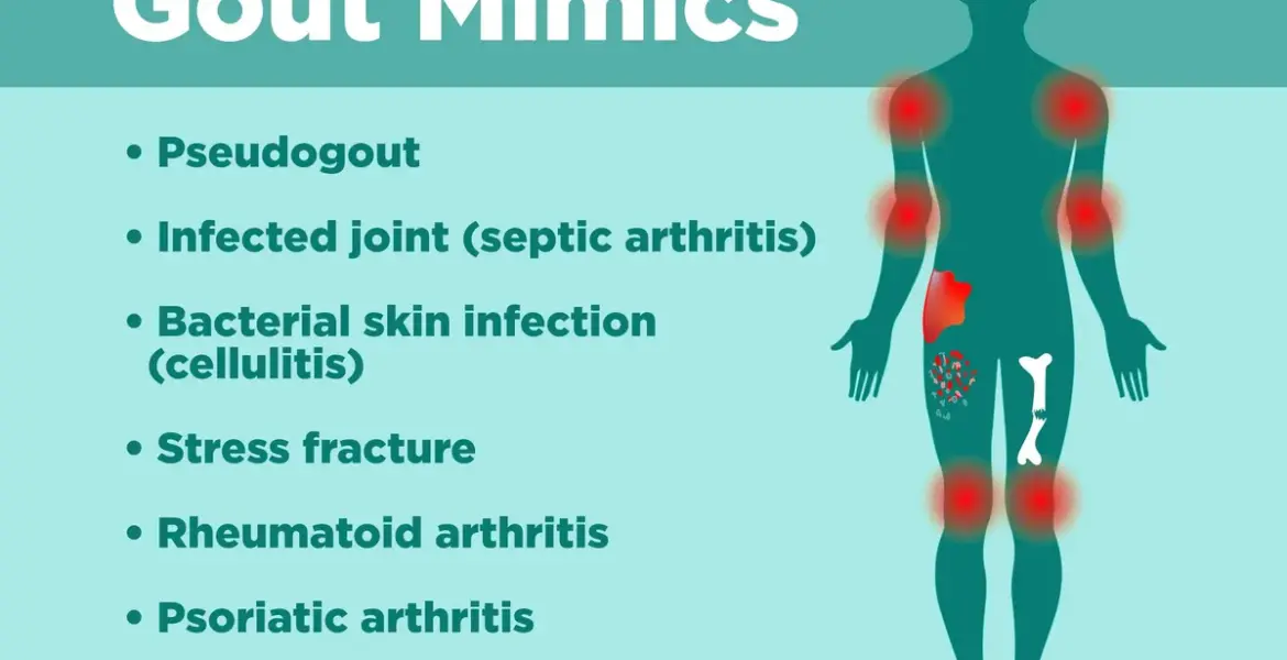 gout gout — GB news