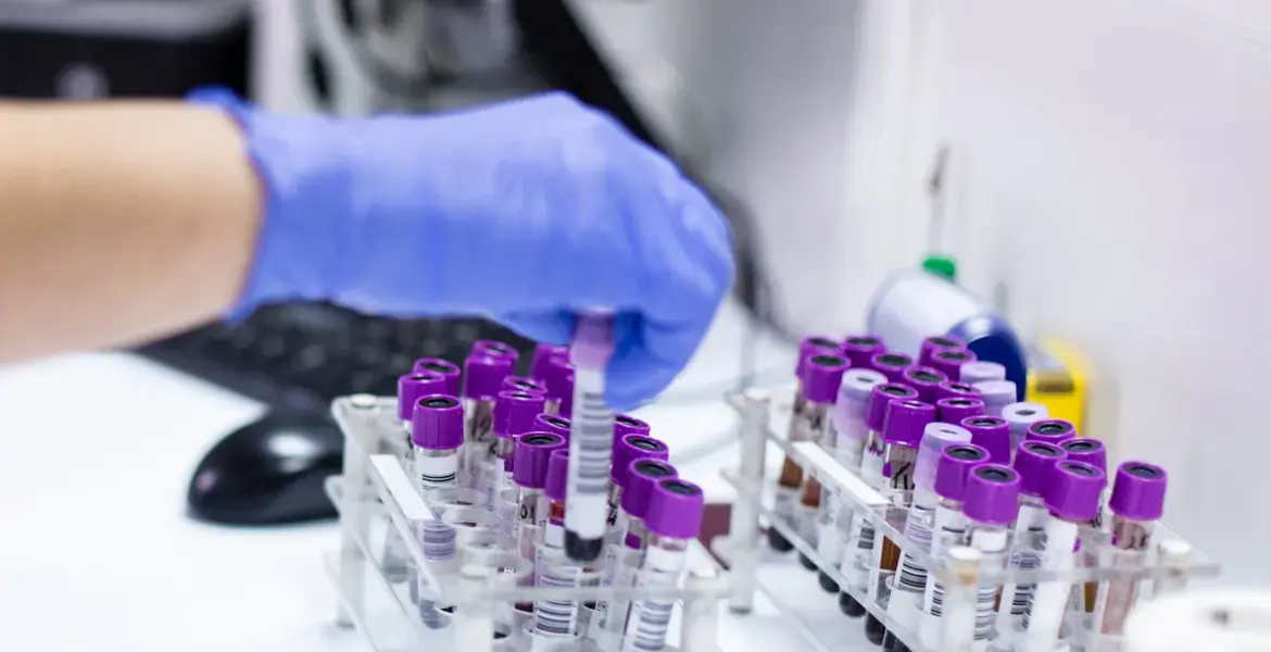 colorectal cancer — GB news