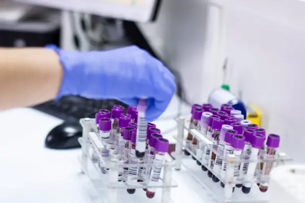 colorectal cancer — GB news